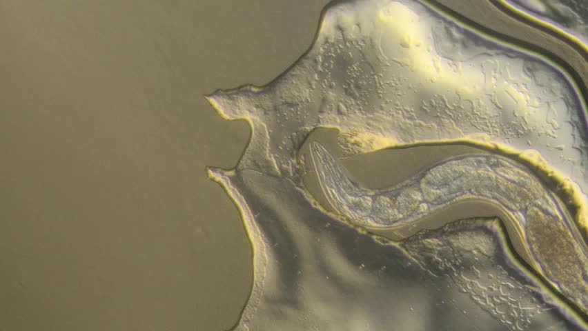Caenorhabditis Elegans A Free