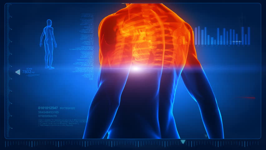 Spine Pain Concept With Rotating Camera And Spine Closeup - Similar