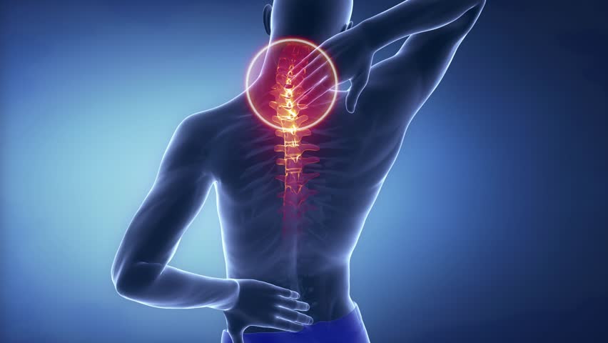 Male Scoliosis In Time Lapse Stock Footage Video 3593012 - Shutterstock