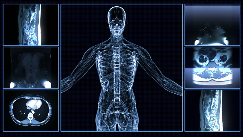 Digital X-Ray Scan Of Human Body HD Stock Footage Video 1762697 ...